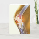 Suche nach nahaufnahme postkarten Voller rahmen