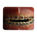 Suche nach körperteile magnete Menschliches körperteil