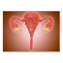 Suche nach uterus postkarten Geschlechtsorgane