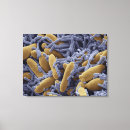 Suche nach falsch leinwandbilder Elektronenmikrografie