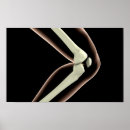 Suche nach knies poster Knochen