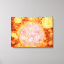 Suche nach virus leinwandbilder Gesundheitswesen