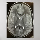 Suche nach scan poster Mri