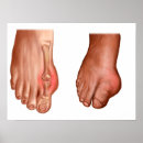 Suche nach menschlicher fuß poster Transparent