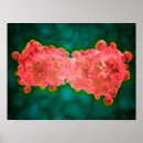 Suche nach hämatologie poster Onkologie