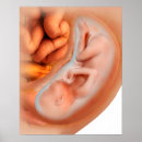 Suche nach entwicklung poster Medizinisch