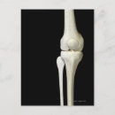 Suche nach knochen postkarten Vorderansicht