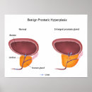 Suche nach reproduktive organe poster Anatomie