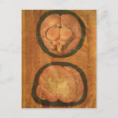 Suche nach anatomischer postkarten Aquapendente