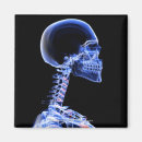 Suche nach nacken magnete Menschen