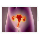 Suche nach uterus postkarten Weibliche anatomie