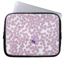 Suche nach gesundheitswesen und medizin laptop schutzhüllen Medizinisch