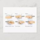 Suche nach methoden postkarten Für alle