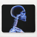 Suche nach röntgenstrahlen mousepads Menschlich