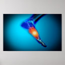 Suche nach gelenk poster Verbindung