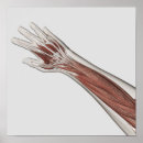 Suche nach menschlicher arm poster Biomedizinische illustrationen