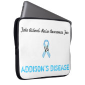 15 im Schossspitzenfall Laptopschutzhülle (Vorne Rechts)