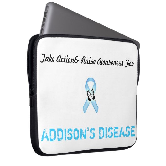 15 im Schossspitzenfall Laptopschutzhülle (Vorne Rechts)