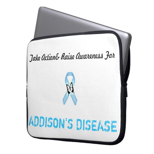 15 im Schossspitzenfall Laptopschutzhülle (Vorderseite Links)