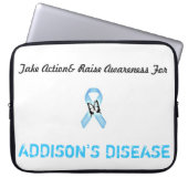 15 im Schossspitzenfall Laptopschutzhülle (Vorderseite)