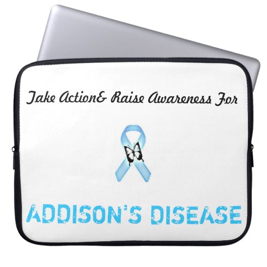 15 im Schossspitzenfall Laptopschutzhülle (Vorderseite)