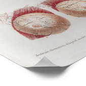 1833 Vintag Nerves Head-Face Anatomy Poster (Ecke)