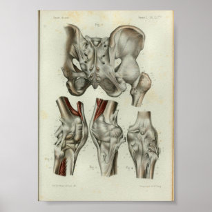 1844 Vintage Anatomie Druck Angesagtes Knie Poster