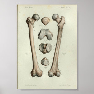 1844 Vintage Anatomie-Druck Femur-Knochen Poster