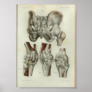 1844 Vintage Anatomie-Druck Hüfte Knie Poster