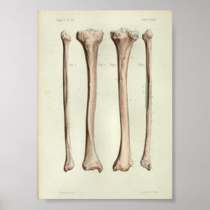 1844 Vintage Anatomie-Druck Tibia Fibula Poster