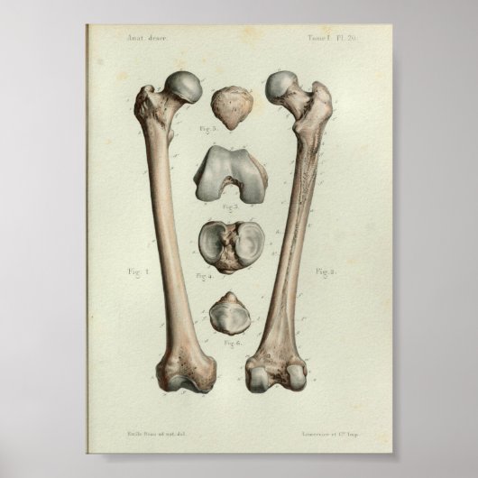 1844 Vintage Anatomie Druckfemurknochen Poster (Vorne)