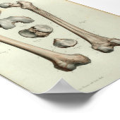 1844 Vintage Anatomie Druckfemurknochen Poster (Ecke)