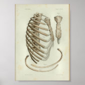 1844 Vintage Anatomie Druckkäfig Poster (Vorne)