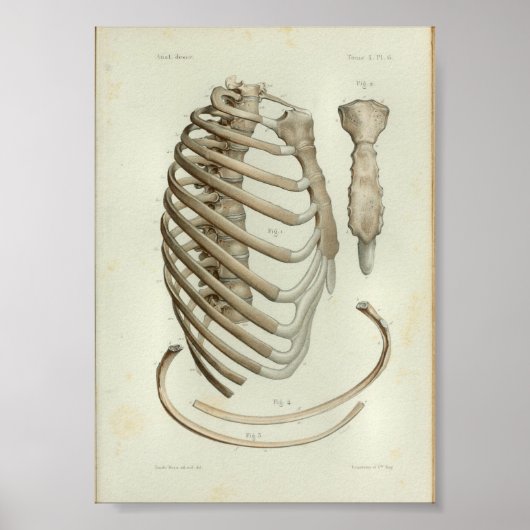 1844 Vintage Anatomie Druckkäfig Poster (Vorne)