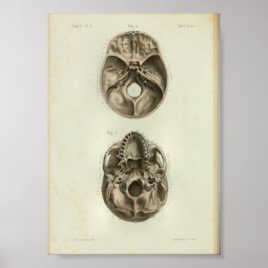 1844 Vintage Anatomie Druckmenschlicher Schädel Poster (Vorne)