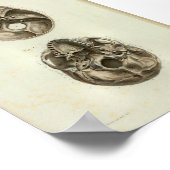 1844 Vintage Anatomie Druckmenschlicher Schädel Poster (Ecke)