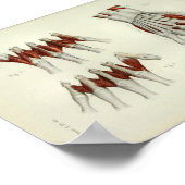 1844 Vintage Anatomie Druckmuskeln Hand Poster (Ecke)