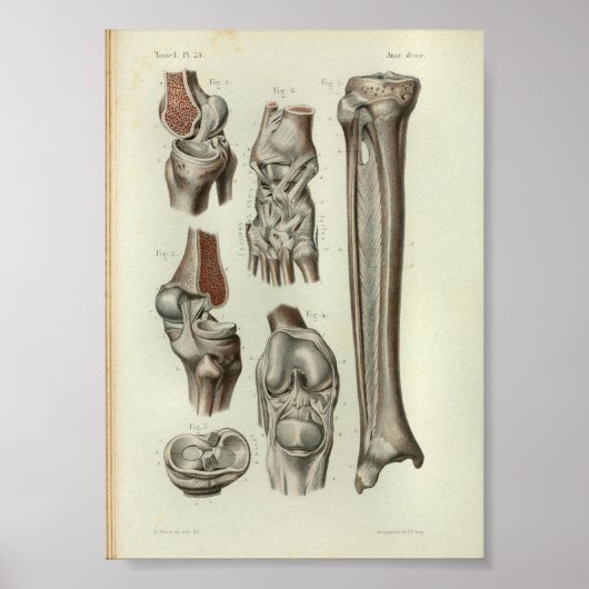 1844 Vintage Anatomie Kniebeutel Poster (Vorne)