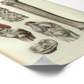 1844 Vintage Anatomie Kniebeutel Poster (Ecke)