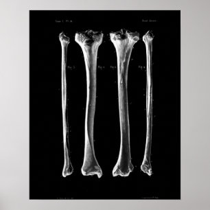 1844 Vintage Anatomie Print Tibia Fibula Poster