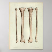 1844 Vintage Anatomie Print Tibia Fibula Poster (Vorne)