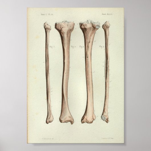 1844 Vintage Anatomie Print Tibia Fibula Poster (Vorne)
