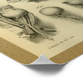 1850 Vintage Anatomie Augenmuskeln Poster (Ecke)