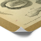 1850 Vintage Anatomie Druck Auge Poster (Ecke)