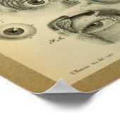 1850 Vintage Anatomie Druck menschliches Auge Poster (Ecke)