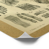 1850 Vintage Anatomie Druckfussmuskeln Poster (Ecke)