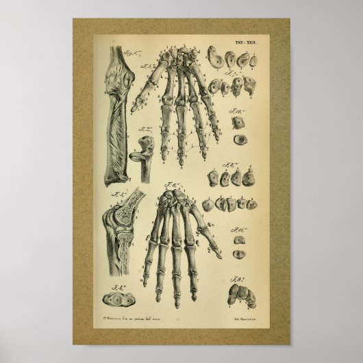 1850 Vintage Anatomie Druckhandknochen Mensch Poster (Vorne)