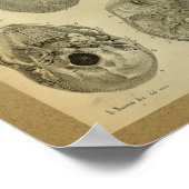 1850 Vintage Anatomie Druckkopf Poster (Ecke)