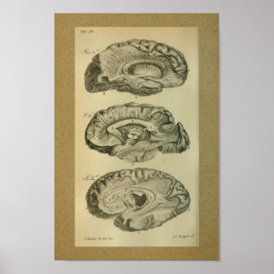 1850 Vintage Anatomie-Gehirnlobes Poster