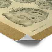 1850 Vintage Anatomie Print Human Heart Poster (Ecke)